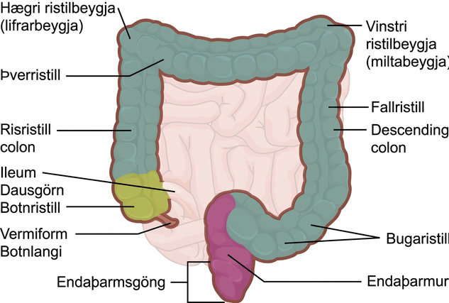 Skýringarmynd merkir botnristil og botnlanga, risristil, hægri ristilbeygju, þverristil, vinstri ristilbeygju, fallristil, bugaristil, endaþarm og endaþarmsgöng ásamt aðlægri dausgörn.