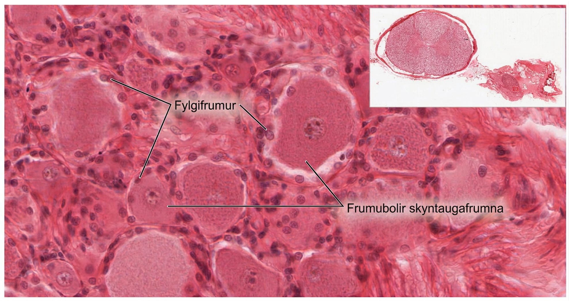 Ljósörmyndin sýnir stækkaða mænuhnoðu með fylgifrumum og frumubolum skyntaugafrumna.