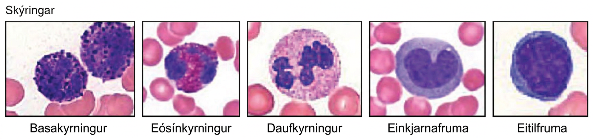 Myndin sýnir smásjármyndir af fimm gerðum hvítkorna. Frá vinstri eru basakyrningur, sýrukyrningur, daufkyrningur, einkyrningur og eitilfruma.