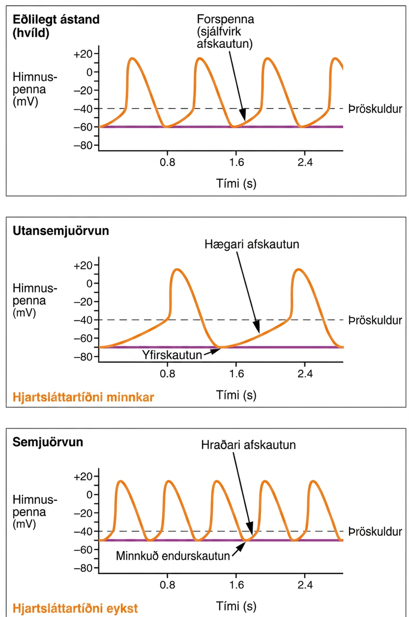 Þrjú línurit sýna himnuspennu yfir tíma. Efst er gangráðsspenna við eðlilegan hvíldartakt, í miðju hægari takt eftir utansemjuörvun og neðst hraðari takt eftir semjuörvun.