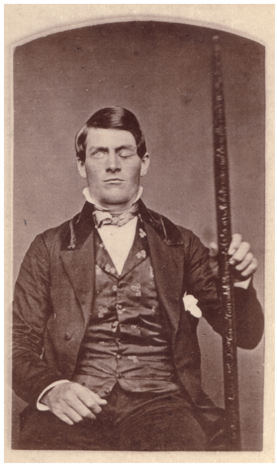 Ljósmyndin sýnir Phineas Gage halda á málmstönginni sem gekk í gegnum framennisbörk hans.