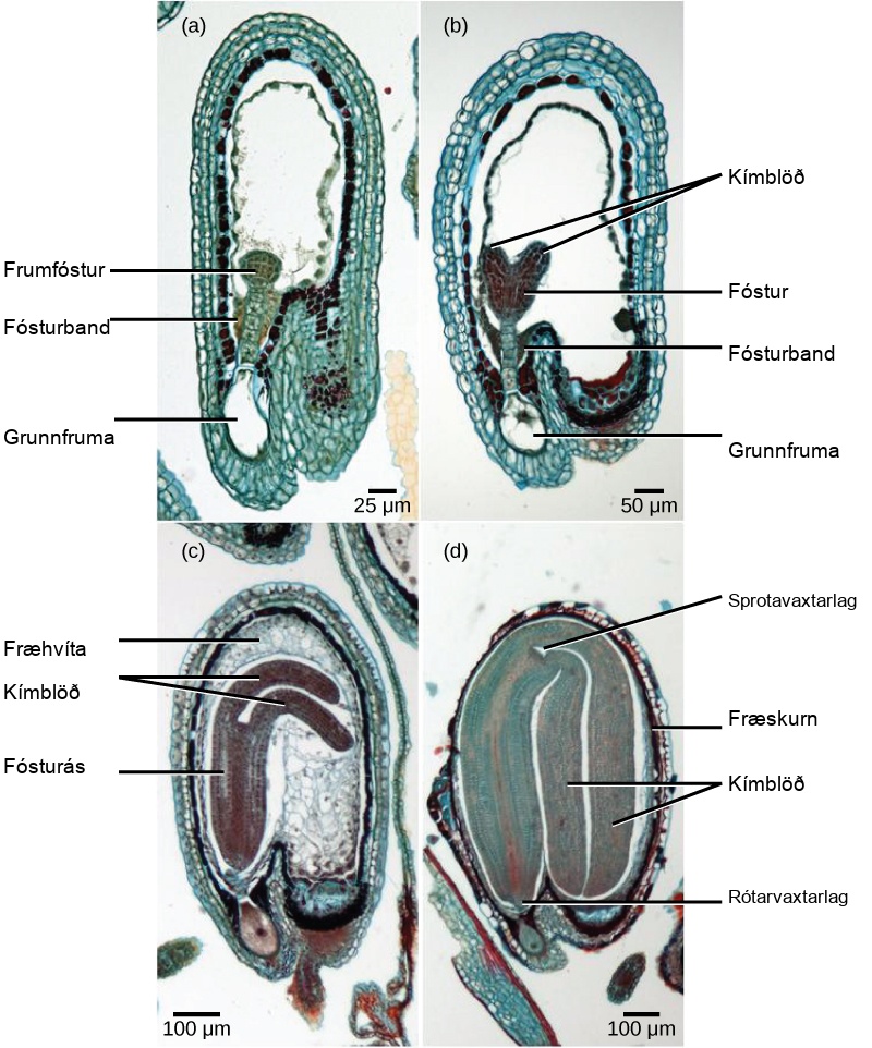 Micrograph A shows a seed in the initial stage of development. The proembryo grows inside an oval-shaped ovary with an opening at the bottom. The basal cell is at the bottom ovary, and suspensor cells are above it. The globular proembryo grows at the top of the suspensor. Micrograph B shows the second stage of development, in which the embryo grows into a heart-shape. Each bump in the heart is a cotyledon. Micrograph C shows the third stage of development. The embryo has grown longer and wider, and the cotyledons have grown into long extensions resembling bunny ears bent so they fit inside the seed. Cells inside the embryo grow in vertical columns. The central column, between the two ears, is called the embryonic axis. Micrograph D shows the fourth stage of development. The bunny ears are now as large as the main part of the embryo, and completely folded over. The base of the embryo is the root meristem, and the space between the two ears is the shoot meristem. A seed coat has formed over the ovary.