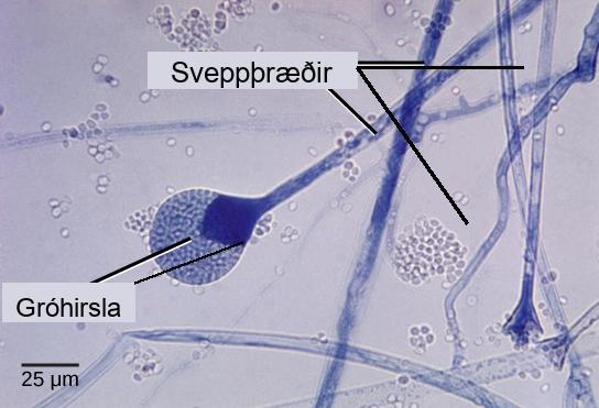 Micrograph shows several long, thread-like hyphae stained blue. One hypha has a round sporangium, about 35 microns in diameter, at the tip. The sporangium is dark blue at the neck, and grainy white and blue elsewhere. Spores that have already been released appear as small white ovals.