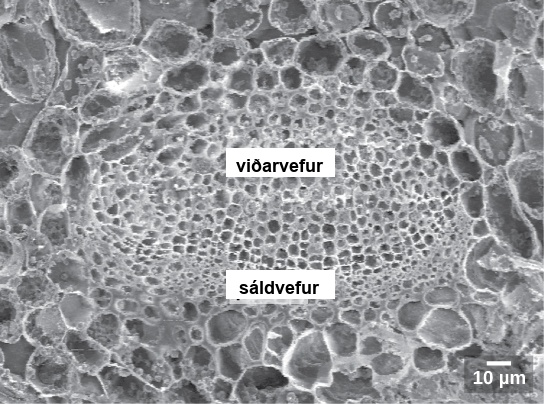 The scanning electron micrograph shows an oval vascular bundle. Small phloem cells make up the bottom of the bundle, and larger xylem cells make up the top. The bundle is surrounded by a ring of larger cells.
