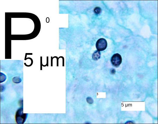 Micrograph shows budding yeast cells. The parent cells are stained dark blue and round, with smaller, teardrop shaped cells budding from them. The cells are about 2 microns across and 3 microns long.