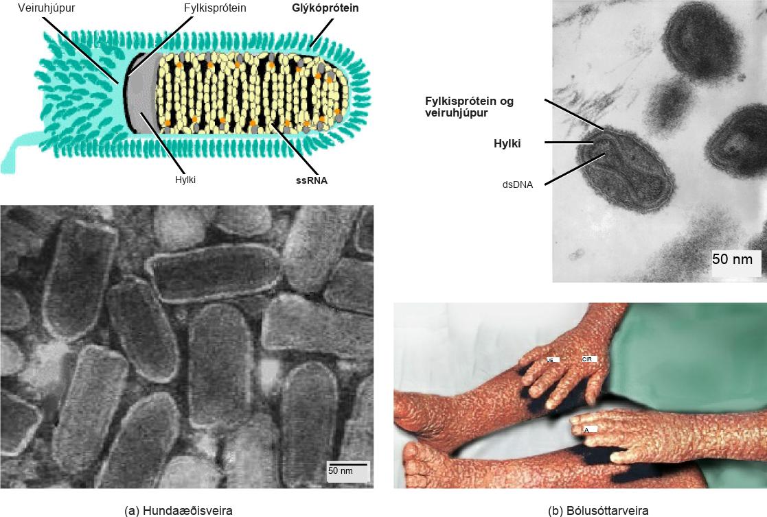 Part a is an illustration of the rabies virus, which is bullet shaped. R N A is coiled inside a capsid, which is encased in a matrix protein lined viral envelope studded with glycoproteins. Part a below is a micrograph of a cluster of bullet shaped rabies viruses. Part b is a micrograph of variola virus, which has D N A encased in a bow shaped capsid. An oval matrix protein-lined envelope surrounds the capsid. Part b below shows irregular, bumpy lesions on the arms and legs of a person with smallpox.