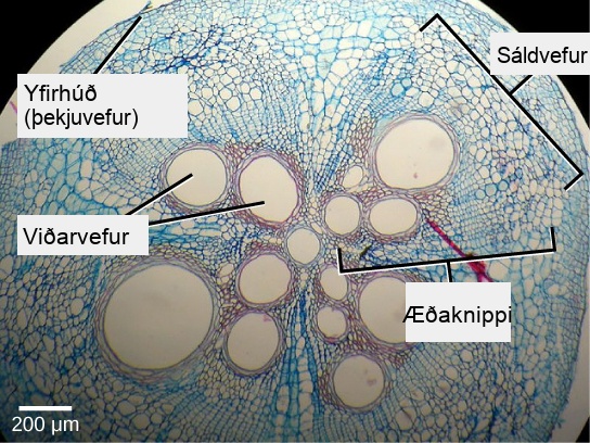 Micrograph shows a round plant stem cross section. There are four teardrop-shaped vascular bundles, with the narrow point of the teardrop meeting at a round xylem vessel. Within each teardrop near the center are two to four more xylem vessels. To the outside of the xylem vessels are much smaller phloem cells. The four vascular bundles are encased in ground tissue. Cells of the ground tissue are somewhat larger than phloem. The stem is protected by an outer layer of dermal tissue, made up of several layers of cells smaller than phloem cells.
