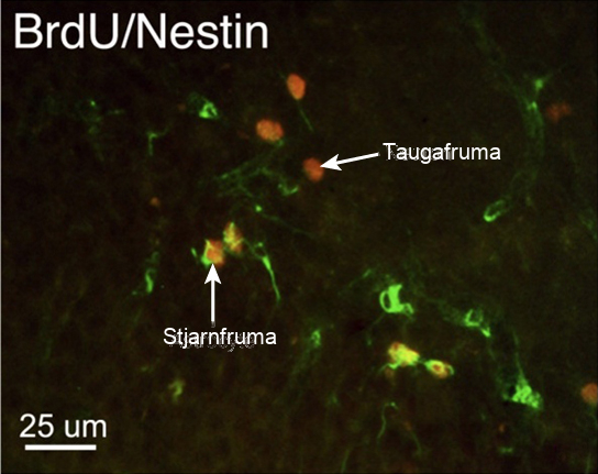 In the micrograph, several cells are fluorescently shown as green only. Three cells are shown as red only, and four cells are shown as being both green and red. The cells shown as green and red are astrocytes, and the cells shown red are neurons. The neurons are oval and about ten microns long. Astrocytes are slightly larger and irregularly shaped.