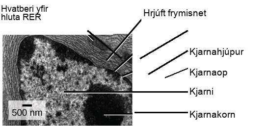 In this transmission electron micrograph, the nucleus is the most prominent feature. The nucleolus is a circular, dark region inside the nucleus. A nuclear pore can be seen in the nuclear envelope that surrounds the nucleus. The rough endoplasmic reticulum surrounds the nucleus, appearing as many layers of membranes. A mitochondrion sits between the layers of the E R membrane.