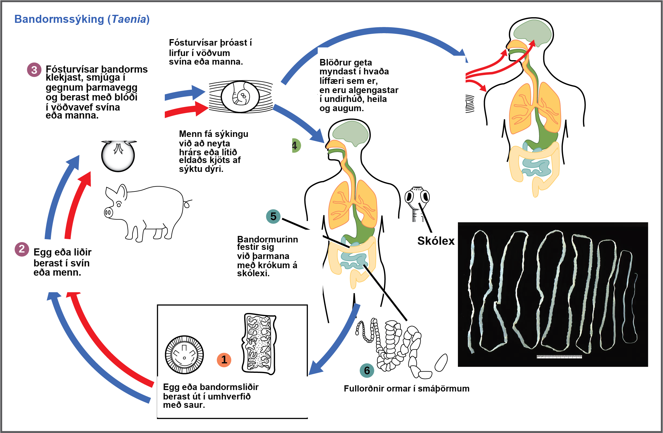The life cycle of a tapeworm begins when eggs or tapeworm segments in the feces (1) are ingested by pigs or humans (2). The embryos hatch, penetrate the intestinal wall, and circulate to the musculature in both pigs and humans (3). This figure shows how humans may acquire a tapeworm infection by ingesting raw or undercooked meat (4). Infection may result in cysts in the musculature, brains, and eyes, or in tapeworms in the intestine. Tapeworms attach themselves to the intestine via a hook-like structure called the scolex (5). Adult tapeworms are then present in the small intestine (6). Tapeworm segments and eggs are excreted in the feces, completing the cycle.