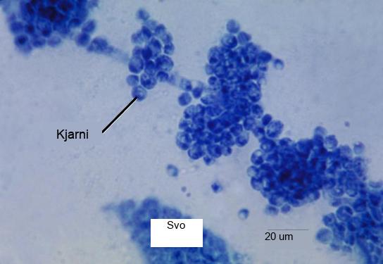 Micrograph shows clumps of small blue spheres. Each sphere is about 5 microns across.