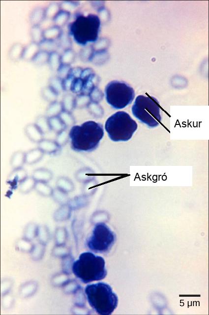 Micrograph shows asci, which appear as multiple, sphere-like shapes fused together into a structure about 7 microns across, and ascospores, which are small, light blue ovals about two microns wide by three microns long released from the asci.