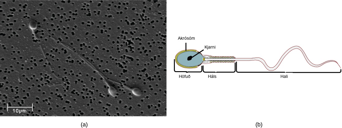 Micrograph shows human sperm, which have an oval head about 3 microns across and a very long flagellum. Illustration shows that the head is surrounded by the acrosome. The part of the tail closest to the head, called the neck, is thicker than the rest.