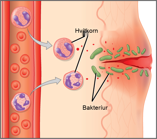 Illustration shows a capillary near the surface of skin that has a cut in it. Bacteria have penetrated the skin around the cut. In response, mast cells in the lower part of the skin tissue release histamines, and dendritic cells release cytokines. The histamines cause the capillary to become permeable. Neutrophils and monocytes exit the capillary into the damaged skin. Both the neutrophil and macrophage release cytokines and consume bacteria by phagocytosis.