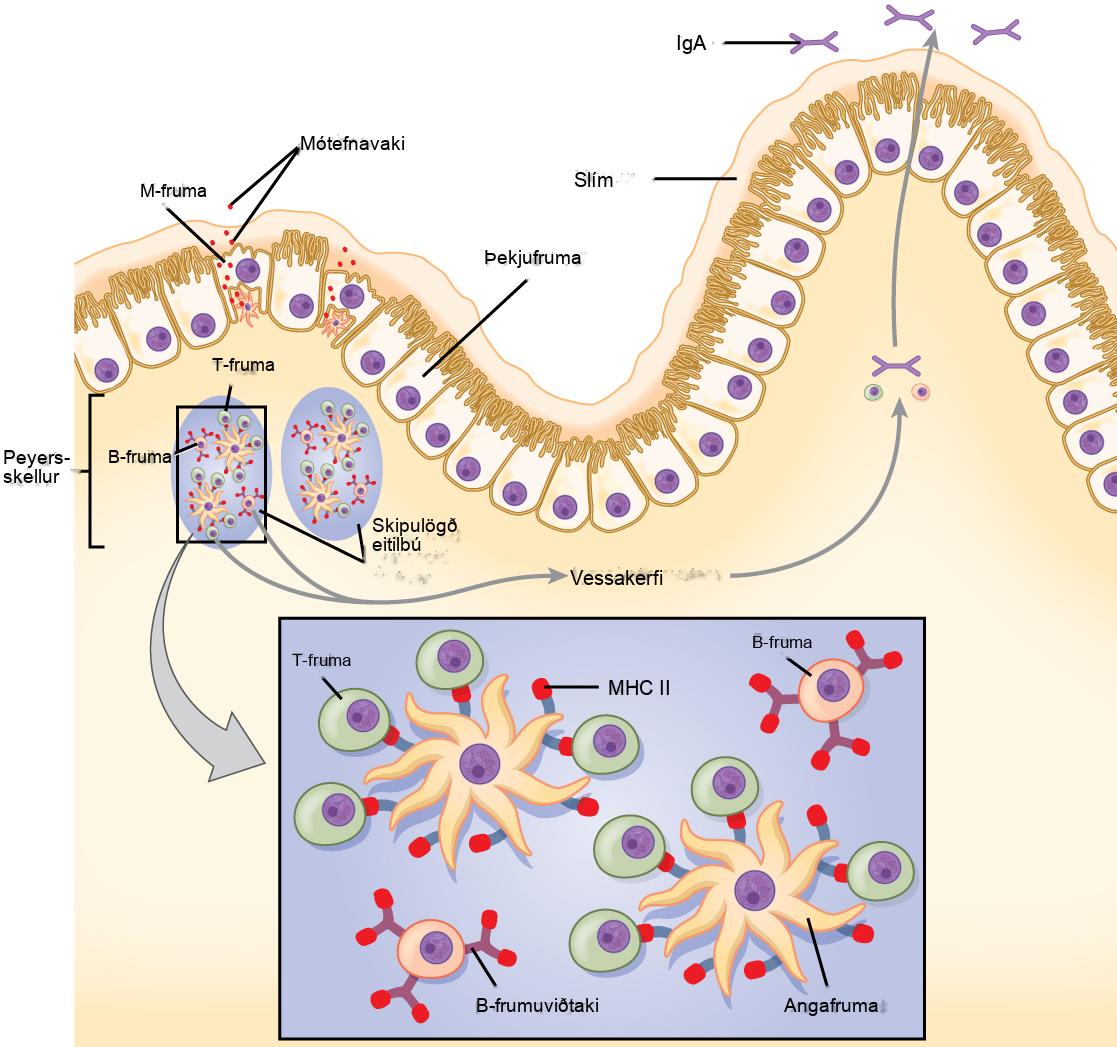 The intestine is lined with epithelial cells with hair-like cilia extending into the intestinal lumen. M cells are sandwiched between these epithelial cells, in bump-like projections in the intestinal lining. The M cells are shaped like an upside-down U, with the U forming a pocket on the interior surface. Antigens are taken up from the intestinal lumen by the M cells, and excreted into this U-shaped pocket. Dendritic cells in the pocket ingest the antigen, then migrate to an area below of the intestinal lining called a Peyer's patch. The dendritic cells, T cells and B cells aggregate to form clumps of cells called organized lymphoid follicles. There, some T cells interact with antigen associated with M H C I I on the surface of the dendritic cells. Some B cells are activated by free antigen. Some antigen-presenting dendritic cells enter the lymphatic system, where more B and T cells are activated in the lymph nodes. The B cells and T cells return to bigger bumps in the intestinal epithelium called MALT effector sites. Antibodies are secreted into the intestinal lumen.