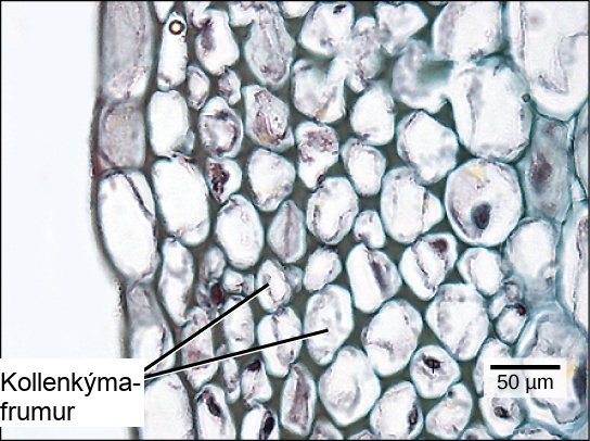 Micrograph shows collenchyma cells, which are irregularly shaped and 25 to 50 microns across. The collenchyma cells are adjacent to a layer of rectangular cells that form the epidermis.