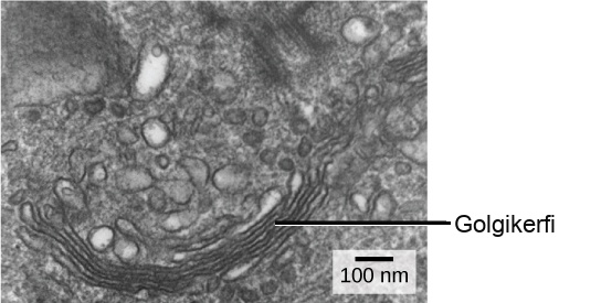 In this transmission electron micrograph, the Golgi apparatus appears as a stack of membranes surrounded by unnamed organelles.