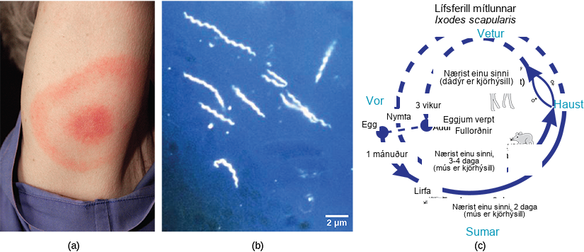 Part A shows the red, bullseye-shaped rash of a person infected with Borrelia. Part B shows a micrograph of Borrelia, which look like tiny corkscrews. Part C shows the life cycle of the bacteria, which begins when Borrelia infect a tick egg. The egg hatches into larva, which feeds on a mouse, then into a nymph, which also feeds on a mouse. The nymph feeds again, this time on a deer, or sometimes a human.