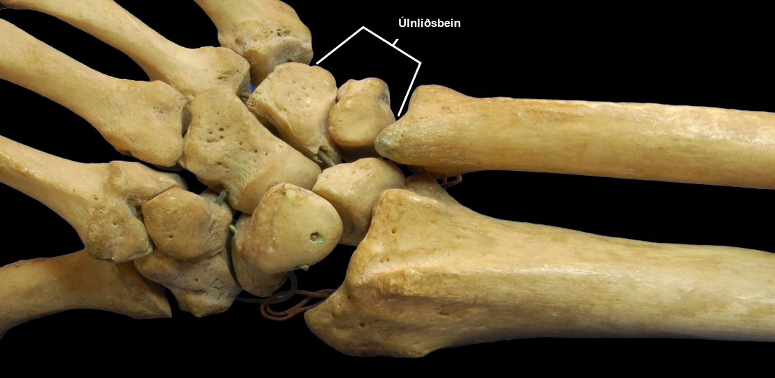 Photo shows a human hand skeleton. The radius and ulna of the forearm connect to several small, knobby bones in the wrist called carpals. Carpals, in turn, connect to bones in the hand.
