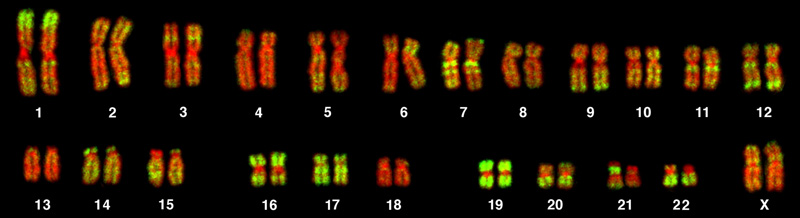 This is a karyotype of a human female. There are 22 homologous pairs of chromosomes and an XX chromosome pair.