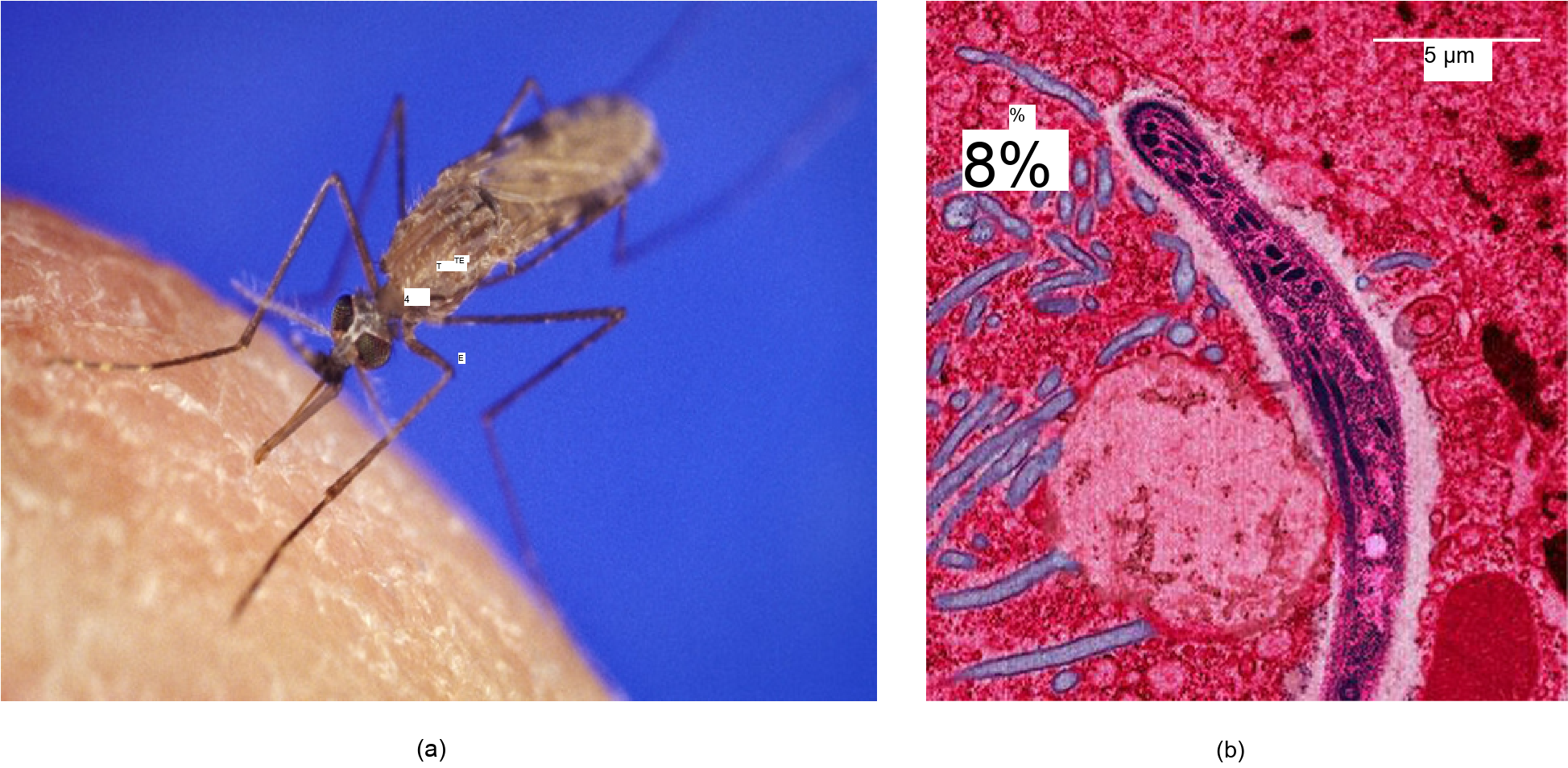 Photo A shows the Anopheles gambiae mosquito, which carries malaria. Photo b shows a micrograph of sickle-shaped Plasmodium falciparum, the parasite that causes malaria. The Plasmodium is about 0.75 microns across.