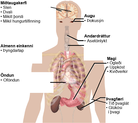 Symptoms of diabetes that affect the central nervous system include excessive thirst, excessive hunger, lethargy and stupor. It affects the eyes via blurred vision. A systemic issue is weight loss. It causes breath that smells like acetone, and affects the respiratory system through hyperventilation. Some of the gastric issues caused are nausea, vomiting, and abdominal pain. The urinary issues caused include frequent urination, and glucose in the urine.