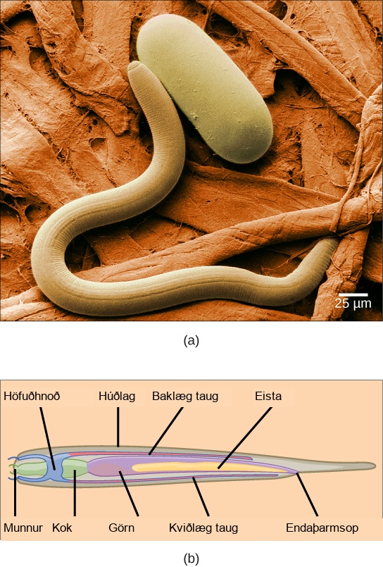 (a) Photo a shows a worm-shaped nematode next to a capsule-shaped nematode egg. (b)The illustration shows a cross-section of a nematode, which has a mouth at one end and an anus at the other. The mouth connects to a pharynx, then to an intestine. Dorsal and ventral nerves run along the top and bottom of the animal and join ring-like head ganglia at the front end. Testes run alongside the intestine toward the back of the animal.