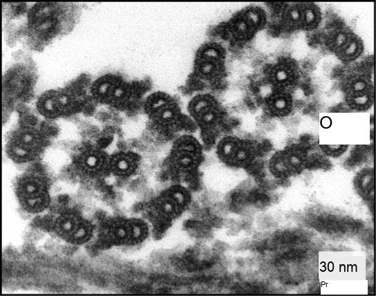 This transmission electron micrograph shows a cross section of nine microtubule doublets that form a hollow tube. Another microtubule doublet sits in the center of the tube.