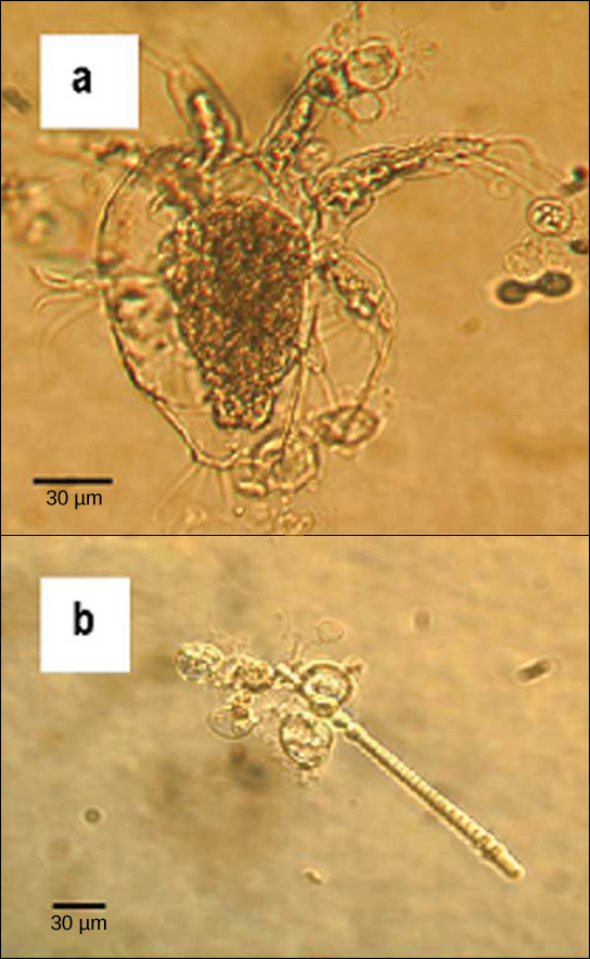 Micrograph A shows an arthropod, which is a teardrop-shaped transparent organism about 90 microns across and 120 microns long. Tentacle-like appendages jut out from the front, wide end of the organism, and clusters of cilia-like appendages jut out from either side and the back. Transparent oval organisms about 20 microns across cling to the arthropod. Micrograph B shows a similar oval transparent organisms clinging to rod-shaped algae about 5 microns across and 200 microns long.