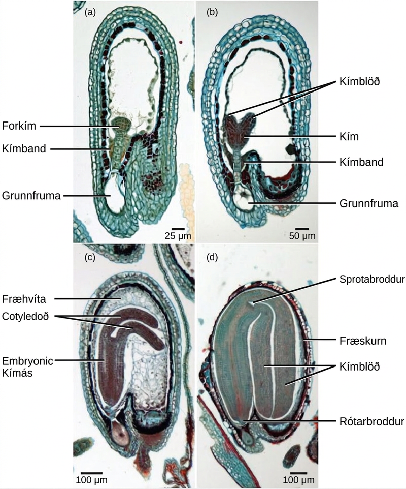 Micrograph A shows a seed in the initial stage of development. The proembryo grows inside an oval-shaped ovary with an opening at the bottom. The basal cell is at the bottom ovary, and suspensor cells are above it. The globular proembryo grows at the top of the suspensor. Micrograph B shows the second stage of development, in which the embryo grows into a heart-shape. Each bump in the heart is a cotyledon. Micrograph C shows the third stage of development. The embryo has grown longer and wider, and the cotyledons have grown into long extensions resembling bunny ears bent so they fit inside the seed. Cells inside the embryo grow in vertical columns. The central column, between the two ears, is called the embryonic axis. Micrograph D shows the fourth stage of development. The bunny ears are now as large as the main part of the embryo, and completely folded over. The base of the embryo is the root meristem, and the space between the two ears is the shoot meristem. A seed coat has formed over the ovary.