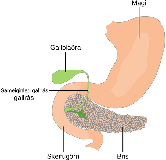 The pancreas is a grainy, teardrop-shaped organ tucked between the stomach and intestine. A common bile duct extends from the pancreas to a small pouch like structure called a gall bladder.