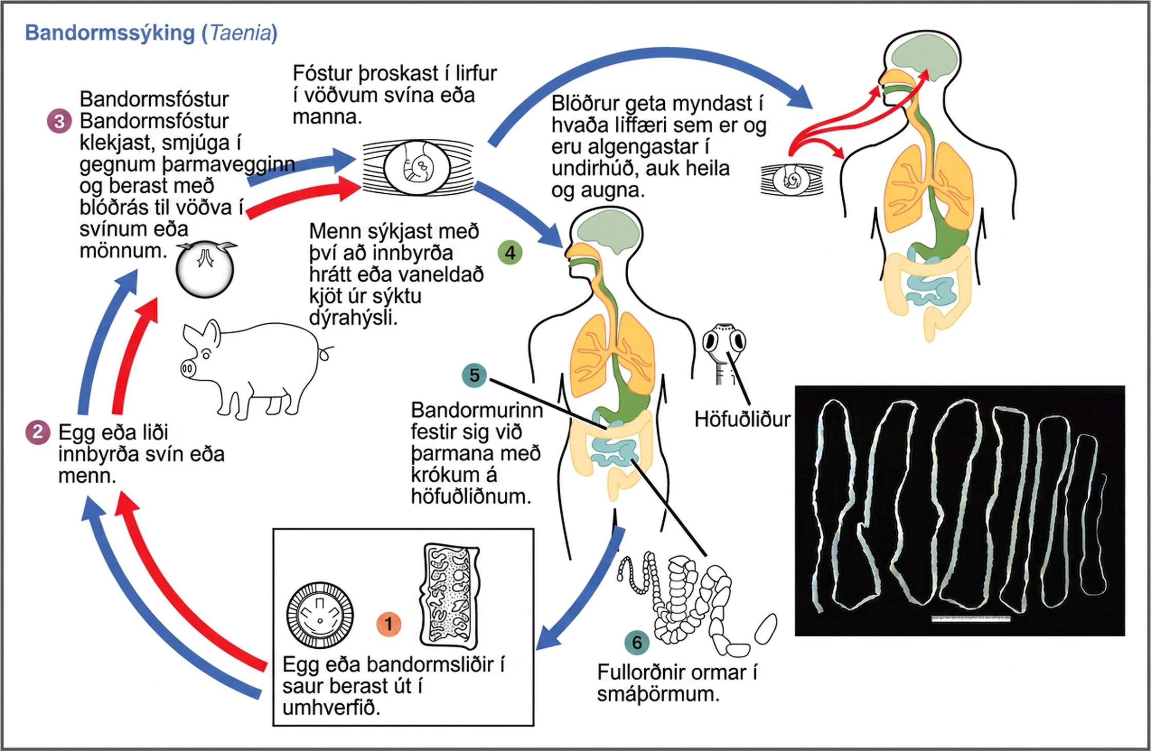 The life cycle of a tapeworm begins when eggs or tapeworm segments in the feces (1) are ingested by pigs or humans (2). The embryos hatch, penetrate the intestinal wall, and circulate to the musculature in both pigs and humans (3). This figure shows how humans may acquire a tapeworm infection by ingesting raw or undercooked meat (4). Infection may result in cysts in the musculature, brains, and eyes, or in tapeworms in the intestine. Tapeworms attach themselves to the intestine via a hook-like structure called the scolex (5). Adult tapeworms are then present in the small intestine (6). Tapeworm segments and eggs are excreted in the feces, completing the cycle.