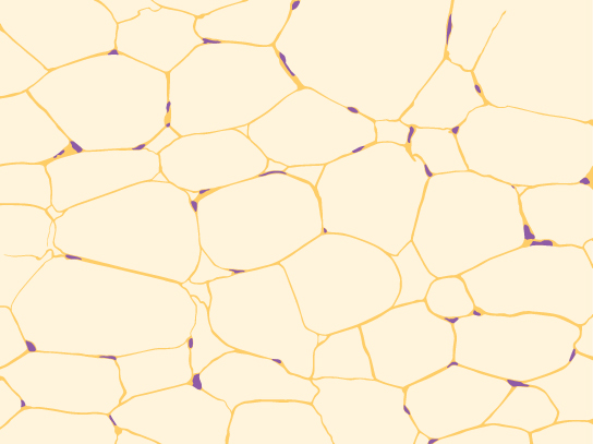 Illustration shows irregularly shaped cells with tiny nuclei clustered next to the cells’ outer membrane.