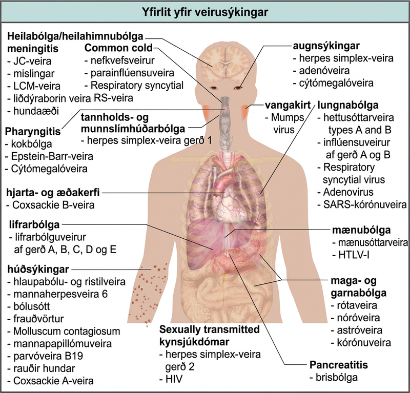 The illustration shows an overview of human viral diseases. Viruses that cause encephalitis or meningitis, or inflammation of the brain and surrounding tissues, include measles, arbovirus, rabies, J C virus, and L C M virus. The common cold is caused by rhinovirus, parainfluenza virus, and respiratory syncytial virus. Eye infections are caused by herpes simple virus, adenovirus, and cytomegalovirus. Pharyngitis, or inflammation of the pharynx, is caused by adenovirus, Epstein-Barr virus, and cytomegalovirus. Parotitis, or inflammation of the parotid glands, is caused by mumps virus. Gingivostomatitis, or inflammation of the oral mucosa, is caused by herpes simplex type I virus. Pneumonia is caused by influenza virus types A and B, parainfluenza virus, respiratory syncytial virus, adenovirus, and SARS coronavirus. Cardiovascular problems are caused by coxsackie B virus. Hepatitis is caused by hepatitis virus types A, B, C, D, and E. Myelitis in the spinal cord is caused by poliovirus and H L T V dash 1. Skin infections are caused by varicella-zoster virus, human herpesvirus 6, smallpox, molluscum contagiosum, human papillomavirus, parvovirus B 19, rubella, measles, and coxsackie A virus. Gastroenteritis, or digestive disease, is caused by adenovirus, rotavirus, norovirus, astrovirus, and coronavirus. Sexually transmitted diseases are caused by herpes simplex type 2, human papillomavirus, and H I V. Pancreatitis is caused by coxsackie B virus.