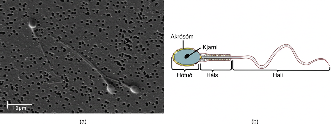 Micrograph shows human sperm, which have an oval head about 3 microns across and a very long flagellum. Illustration shows that the head is surrounded by the acrosome. The part of the tail closest to the head, called the neck, is thicker than the rest.
