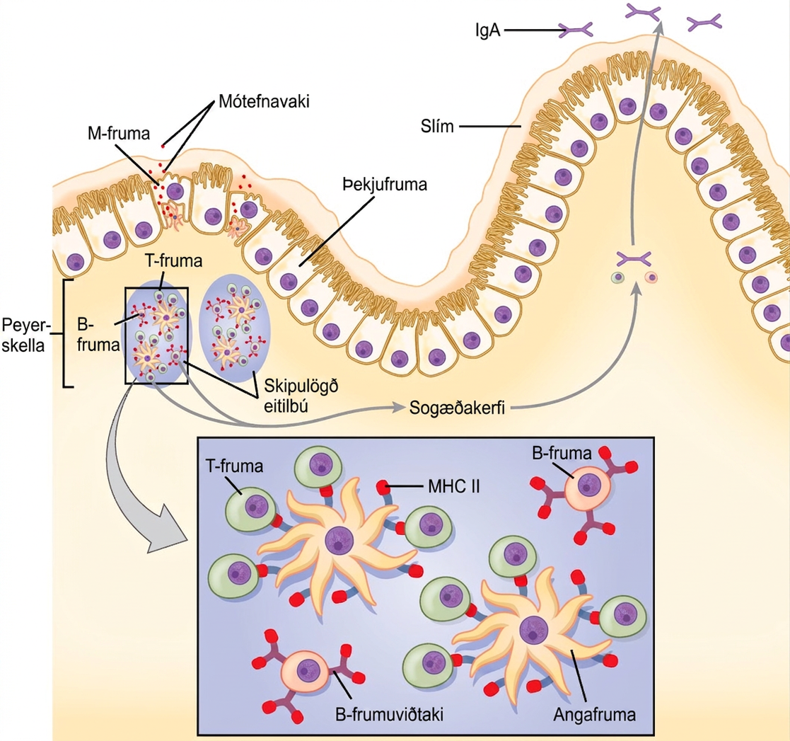 The intestine is lined with epithelial cells with hair-like cilia extending into the intestinal lumen. M cells are sandwiched between these epithelial cells, in bump-like projections in the intestinal lining. The M cells are shaped like an upside-down U, with the U forming a pocket on the interior surface. Antigens are taken up from the intestinal lumen by the M cells, and excreted into this U-shaped pocket. Dendritic cells in the pocket ingest the antigen, then migrate to an area below of the intestinal lining called a Peyer's patch. The dendritic cells, T cells and B cells aggregate to form clumps of cells called organized lymphoid follicles. There, some T cells interact with antigen associated with M H C I I on the surface of the dendritic cells. Some B cells are activated by free antigen. Some antigen-presenting dendritic cells enter the lymphatic system, where more B and T cells are activated in the lymph nodes. The B cells and T cells return to bigger bumps in the intestinal epithelium called MALT effector sites. Antibodies are secreted into the intestinal lumen.