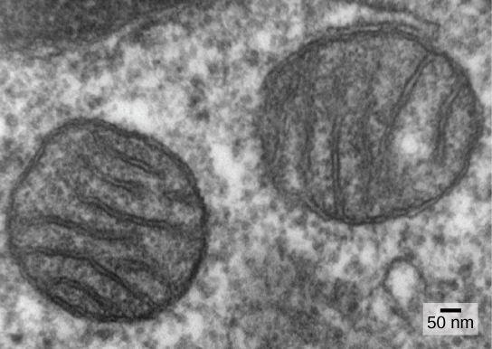 This micrograph shows two round, membrane-bound organelles inside a cell. The organelles are about 400 nanometers (about 0.4 microns) across and have membranes running through the middle of them.