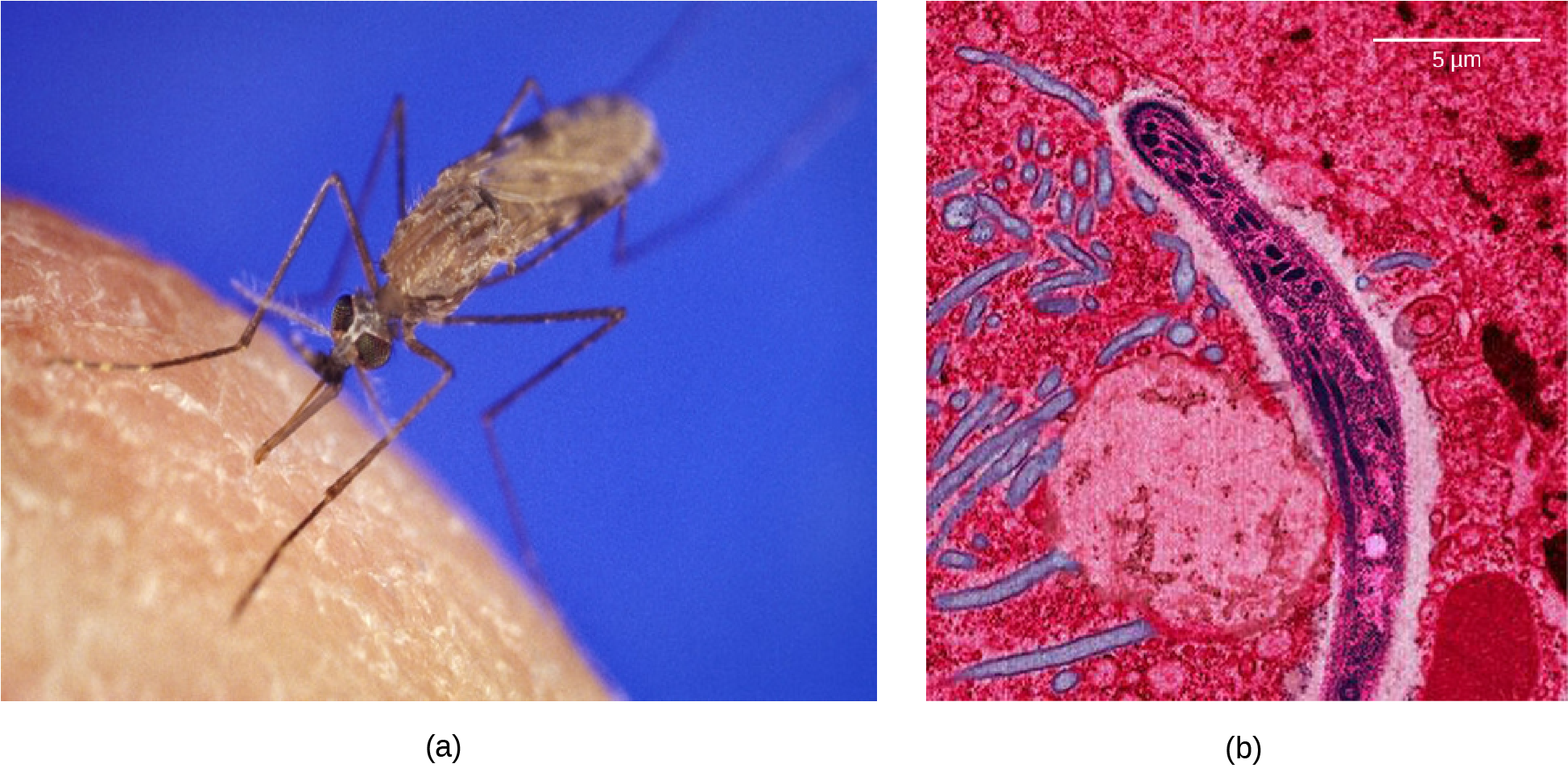Photo A shows the Anopheles gambiae mosquito, which carries malaria. Photo b shows a micrograph of sickle-shaped Plasmodium falciparum, the parasite that causes malaria. The Plasmodium is about 0.75 microns across.