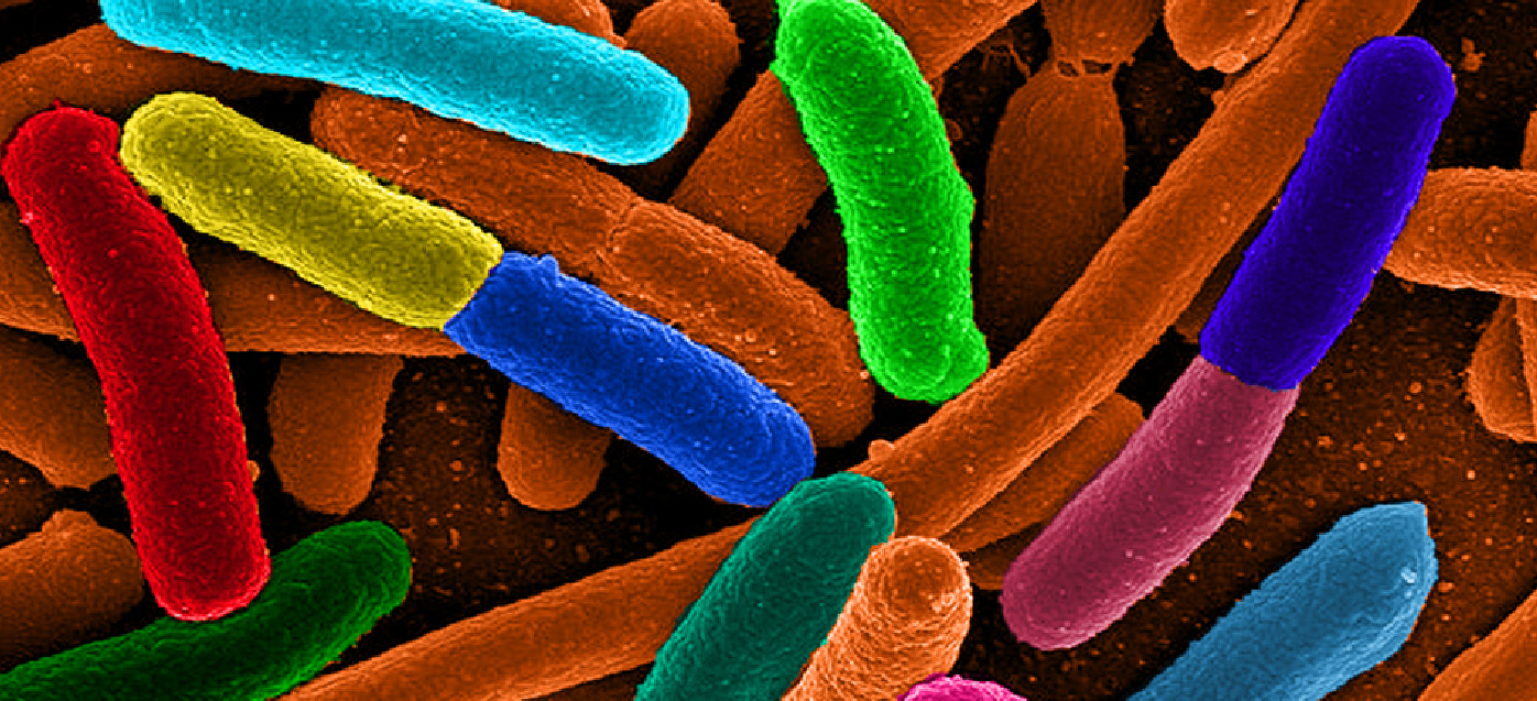 Escherichia coli-bakteríur (E. coli)