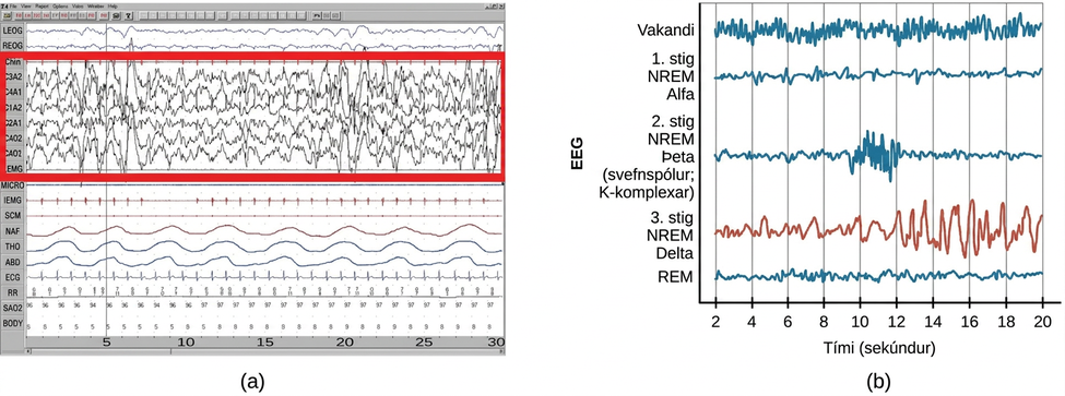 Polysonograph a shows the pattern of delta waves, which are low frequency and high amplitude. Delta waves are found mostly in stage 3 of sleep. Chart b shows brainwaves at various stages of sleep, with stage 3 highlighted.