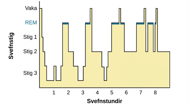 This is a hypnogram showing the transitions of the sleep cycle during a typical eight hour period of sleep. During the first hour, the person goes through stages 1 and 2 and ends at 3. In the second hour, sleep oscillates in stage 3 before attaining a 30-minute period of REM sleep. The third hour follows the same pattern as the second, but ends with a brief awake period. The fourth hour follows a similar pattern as the third, with a slightly longer REM stage. In the fifth hour, stage 3 is no longer reached. The sleep stages are fluctuating from 2, to 1, to REM, to awake, and then they repeat with shortening intervals until the end of the eighth hour when the person awakens.