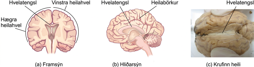 Illustrations (a) and (b) show the corpus callosum’s location in the brain in front and side views. Photograph (c) shows the corpus callosum in a dissected brain.