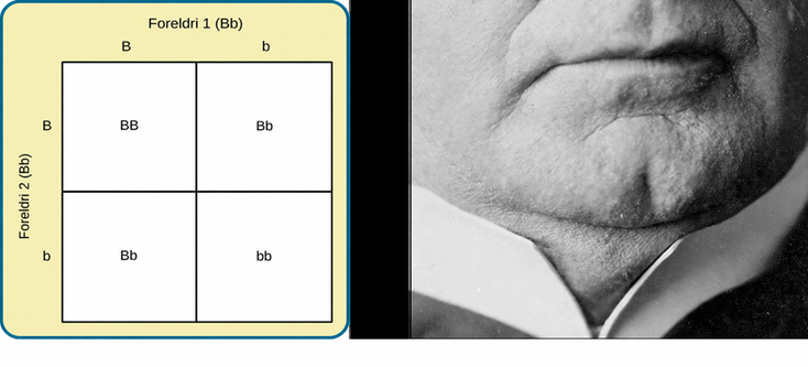 Image (a) is a Punnett square showing the four possible combinations (Bb, bb, Bb, bb) resulting from the pairing of a bb parent and a Bb parent. Image (b) is a close-up photograph showing a cleft chin.