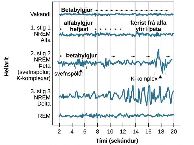 A graph has a y-axis labeled “EEG” and an x-axis labeled “time (seconds.) Plotted along the y-axis and moving upward are the stages of sleep. First is REM, followed by Stage 3 NREM Delta, Stage 2 NREM Theta (sleep spindles; K-complexes), Stage 1 NREM Alpha, and Awake. Charted on the x axis is Time in seconds from 2–20 in 2 second intervals. Each sleep stage has associated wavelengths of varying amplitude and frequency. Relative to the others, “awake” has a very close wavelength and a medium amplitude. Stage 1 is characterized by a generally uniform wavelength and a relatively low amplitude which doubles and quickly reverts to normal every 2 seconds. Stage 2 is comprised of a similar wavelength as stage 1. It introduces the K-complex from seconds 10 through 12 which is a short burst of doubled or tripled amplitude and decreased wavelength. Stage 3 has a more uniform wave with gradually increasing amplitude. Finally, REM sleep looks much like stage 2 without the K-complex.