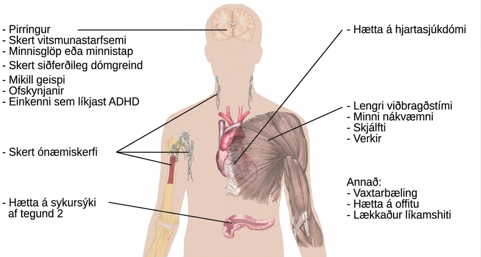 An illustration of the top half of a human body identifies the locations in the body that correspond with various adverse affects of sleep deprivation. The brain is labeled with “Irritability,” “Cognitive impairment,” “Memory lapses or loss,” “Impaired moral judgment,” “Severe yawning,” “Hallucinations,” and “Symptoms similar to ADHD.” The heart is labeled with “Risk of heart disease.” The muscles are labeled with “Increased reaction time,” “Decreased accuracy,” “Tremors,” and “Aches.” There is an organ near the stomach labeled “Risk of diabetes Type 2.” Various parts of the neck, arm, and underarm are labeled “Impaired immune system.” Other risks include “Growth suppression,” “Risk of obesity,” “Decreased temperature.”